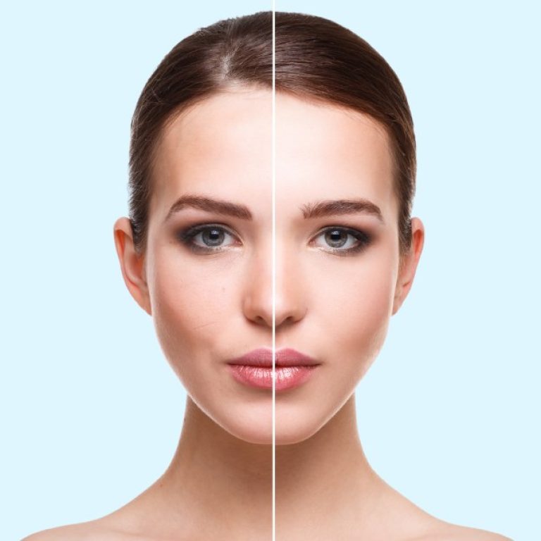 MDW Centre - Achieve Youthful Radiant Skin with Anti Aging Treatment in Aligarh