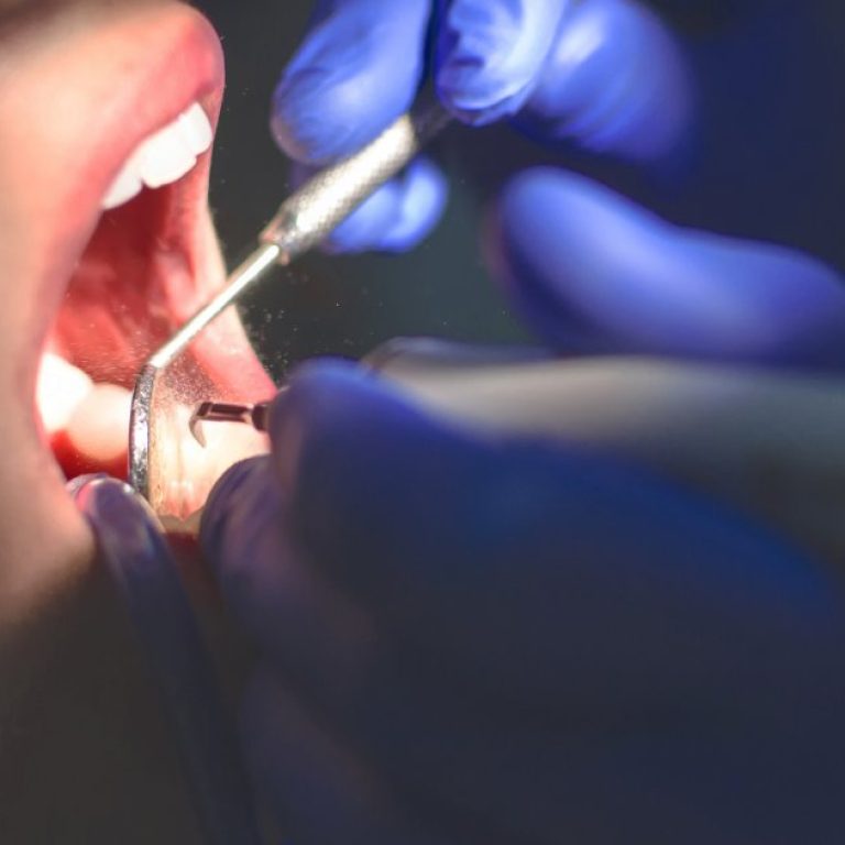 MDW Centre - Achieve a Healthy Smile with the Best Dentist in Aligarh