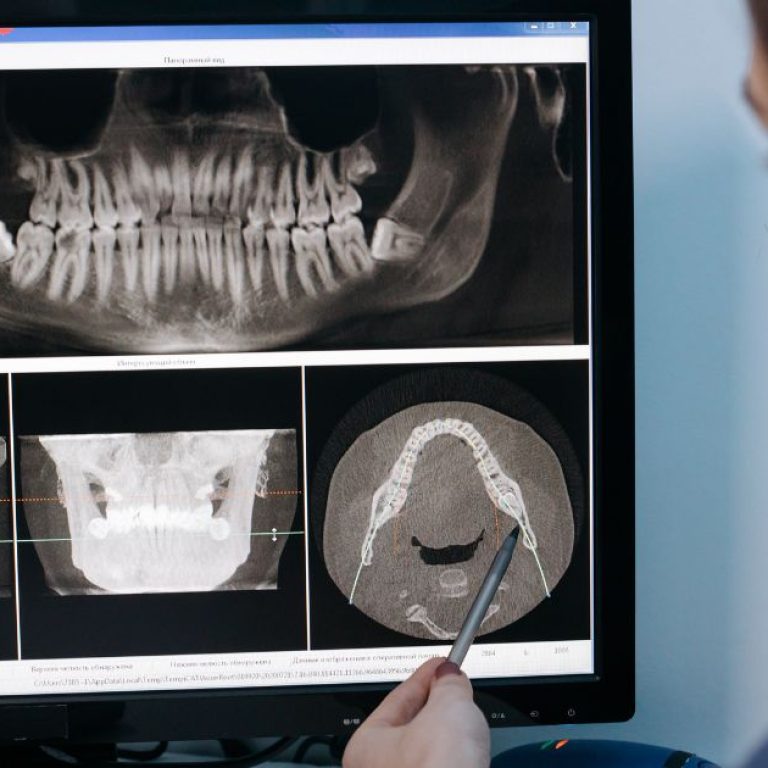 MDW Centre - Best Dental Clinic in Aligarh for Complete Care