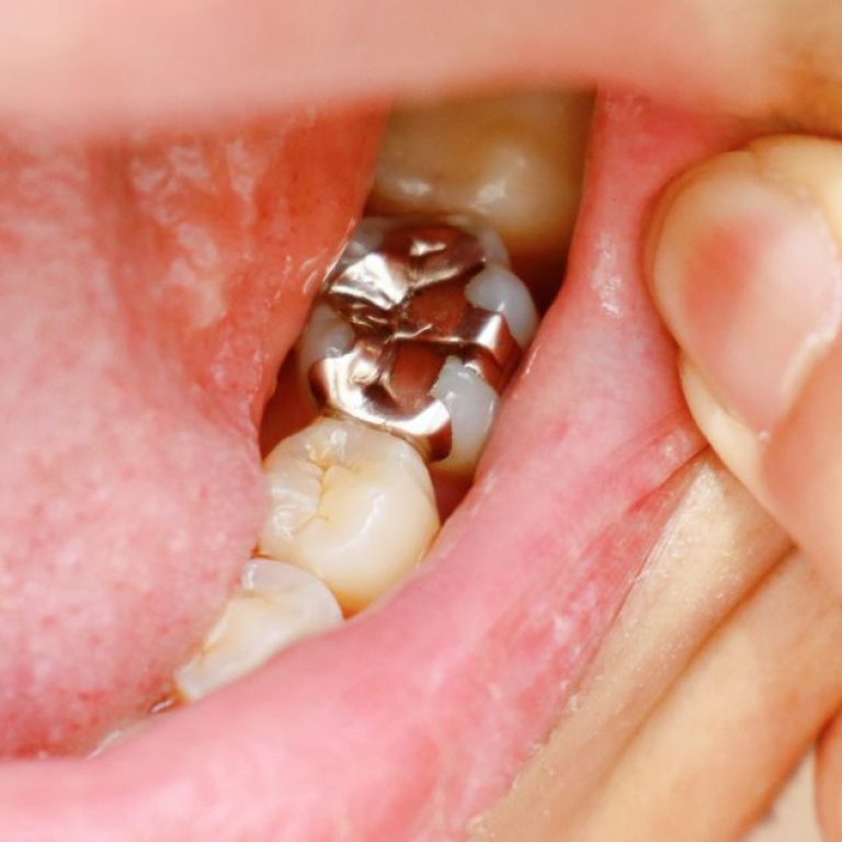 MDW Centre - Best Dental Surgeon in Aligarh for Quality Dental Care
