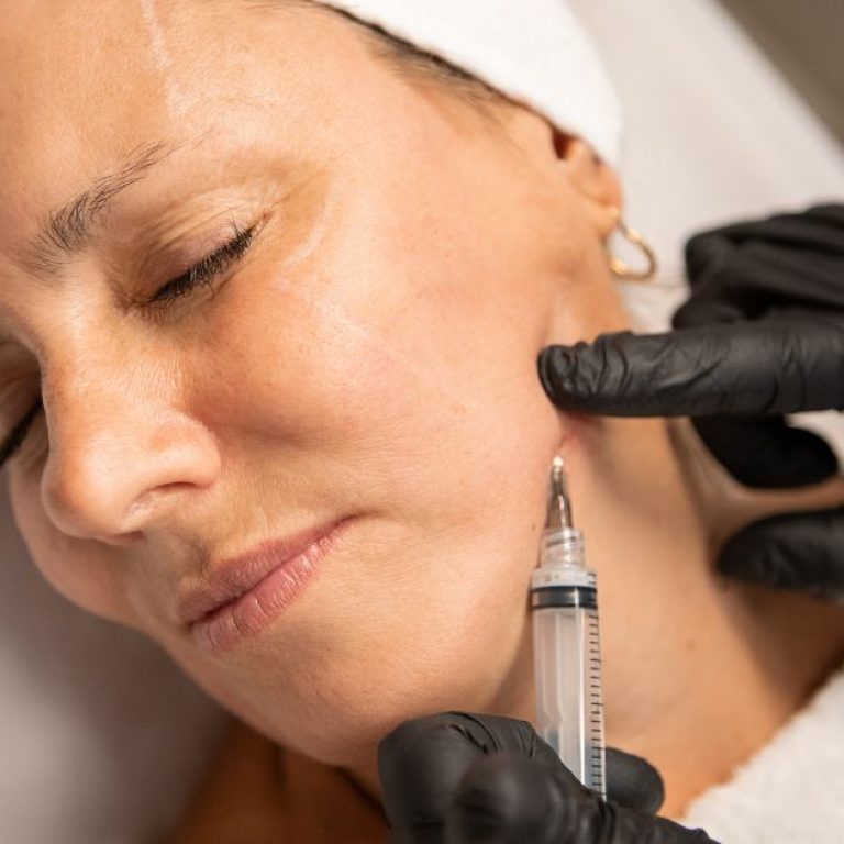 MDW Centre - Best Dermatologist in Aligarh for Skin Hair Care