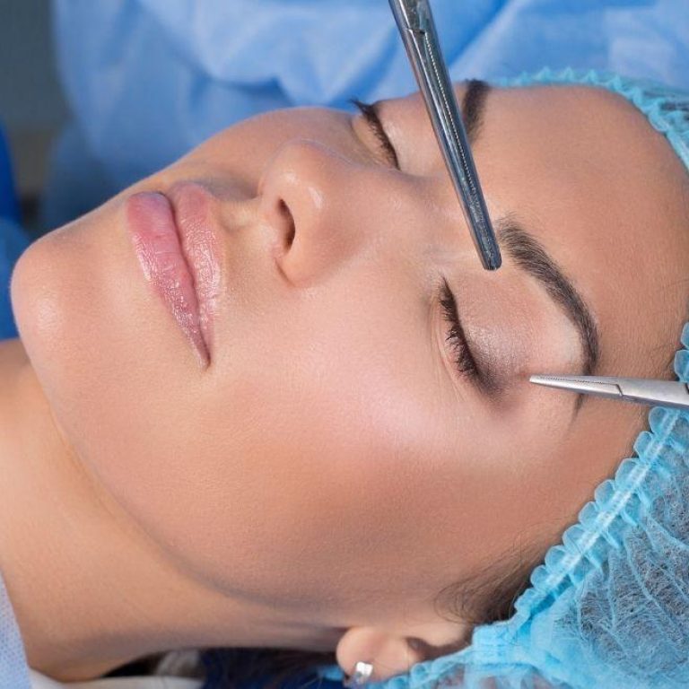 MDW-Centre-EYELID-SURGERY-BLEPHAROPLASTY