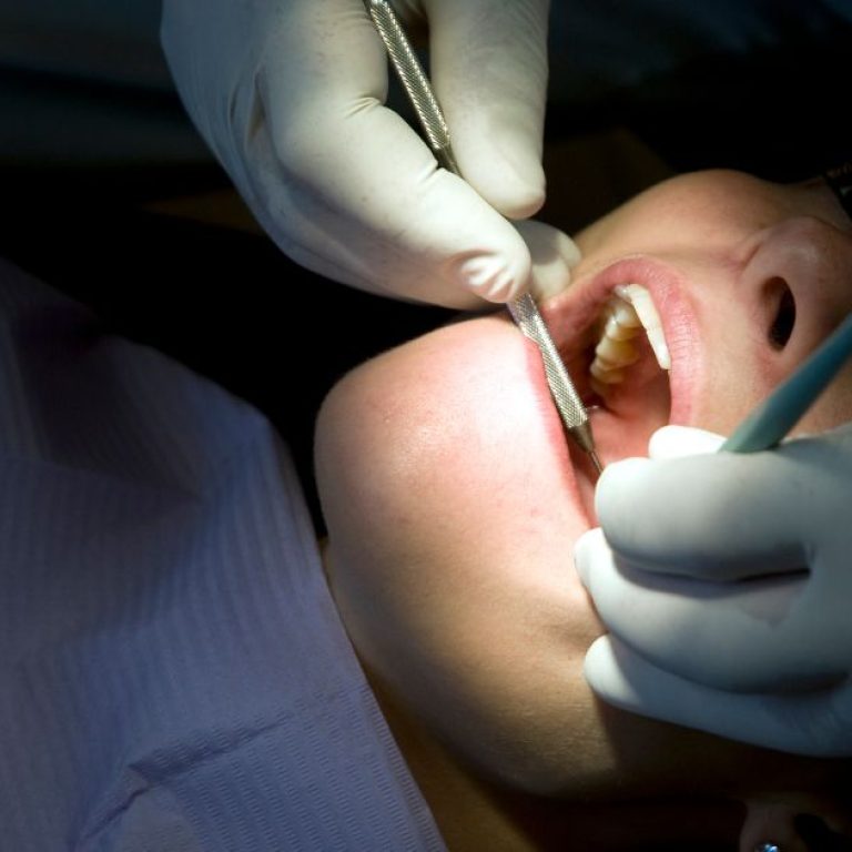MDW Centre - Expert Dental Surgeon in Aligarh for Advanced Dental Treatments