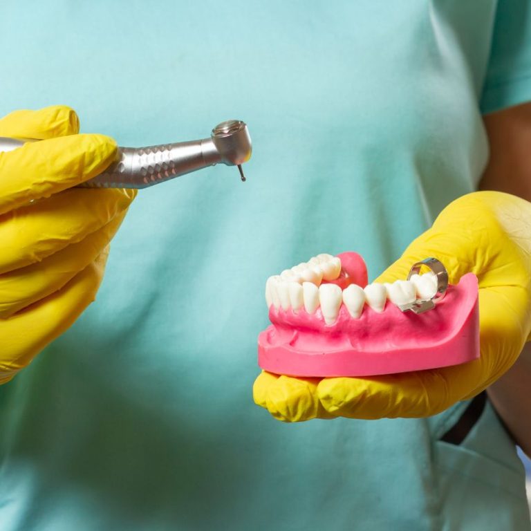 Dental professional in teal scrubs and yellow gloves holds a dental drill and a pink jaw model with implant framework in a clinic setting