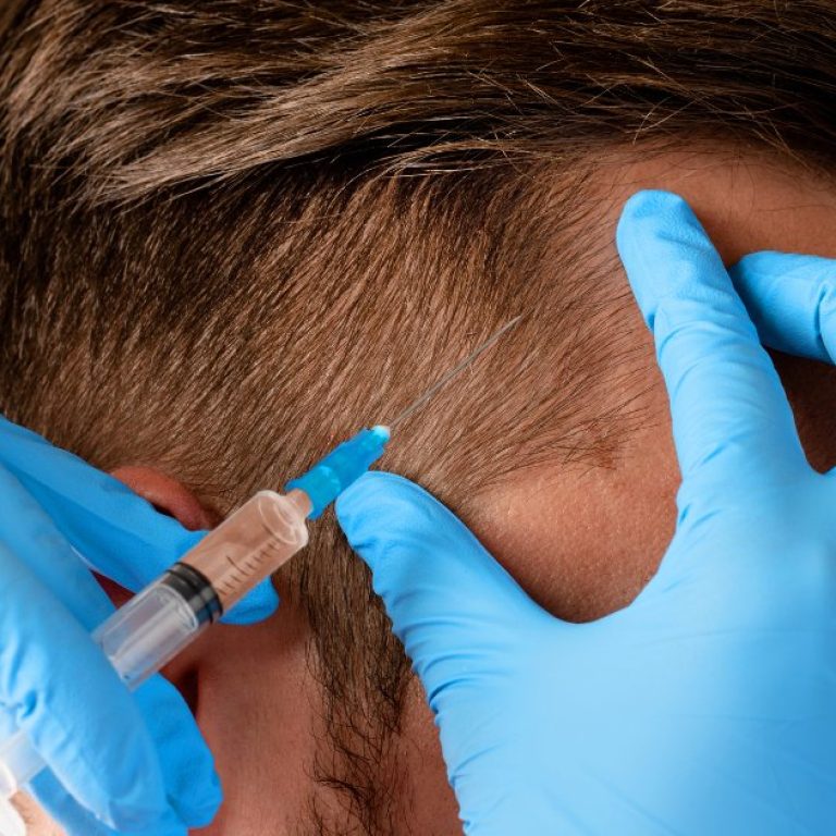 MDW Centre - Find the Best Hair Specialist in Aligarh for Hair Loss Solutions