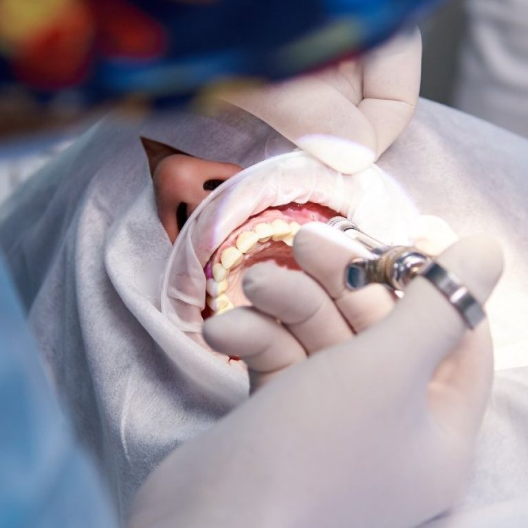 MDW Centre - Get Treated by the Best Dental Surgeon in Aligarh