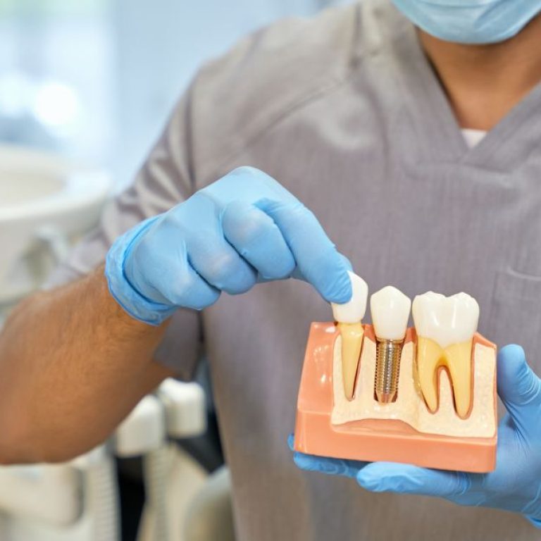 MDW Centre - How to Choose the Best Dental Surgeon in Aligarh Introduction