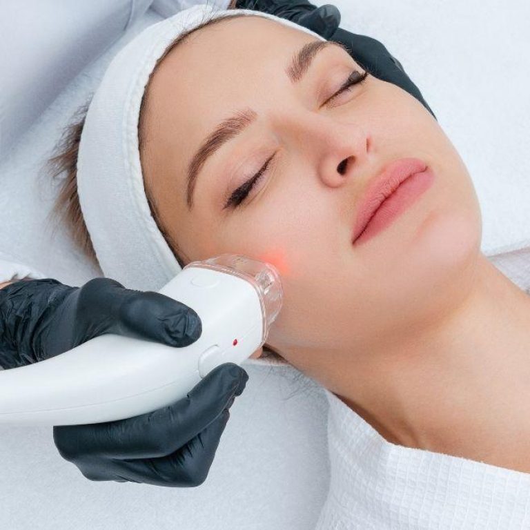 MDW-Centre-Laser-Treatment