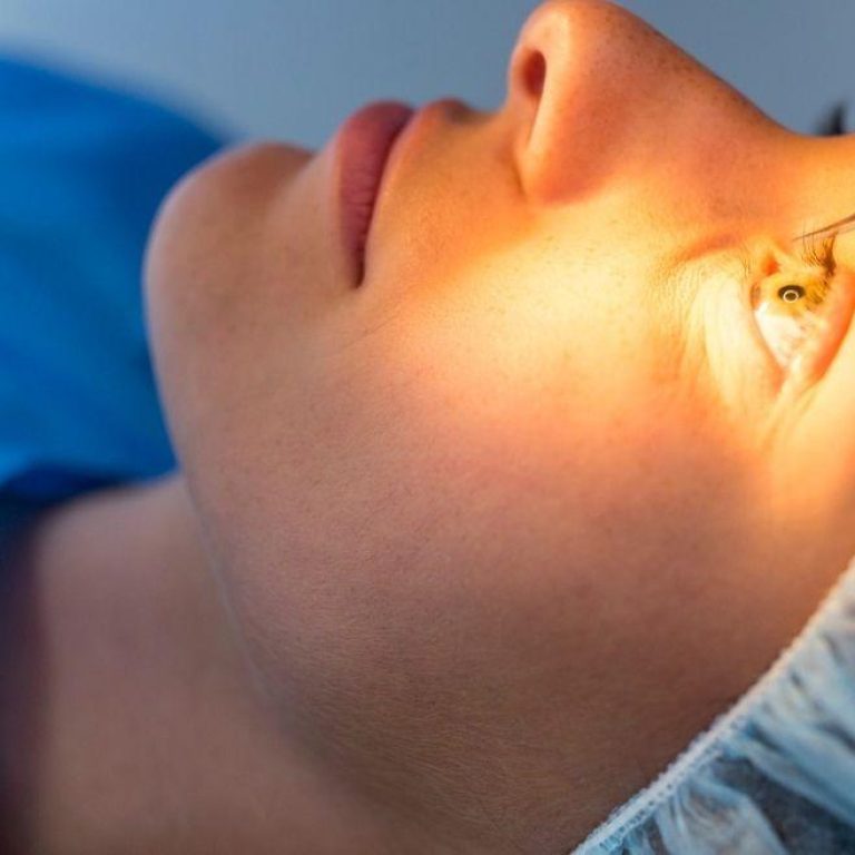 MDW-Centre-OCULOPLASTY