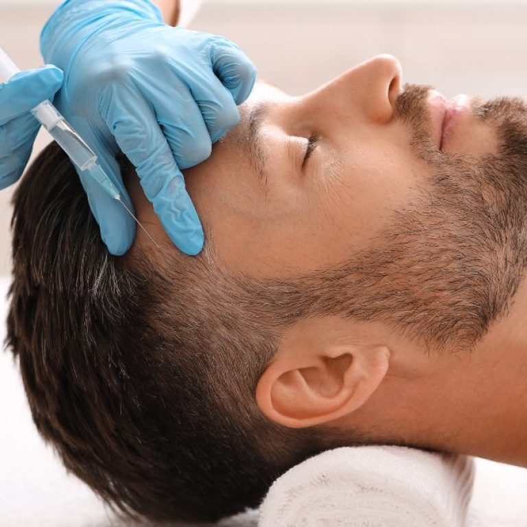 MDW Centre - Regain Your Confidence with Expert Hair Treatments in Aligarh
