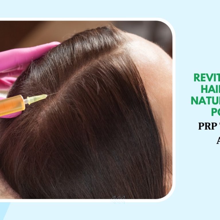 MDW Centre - Revitalize Your Hair with the Natural Healing Power of PRP Therapy in Aligarh