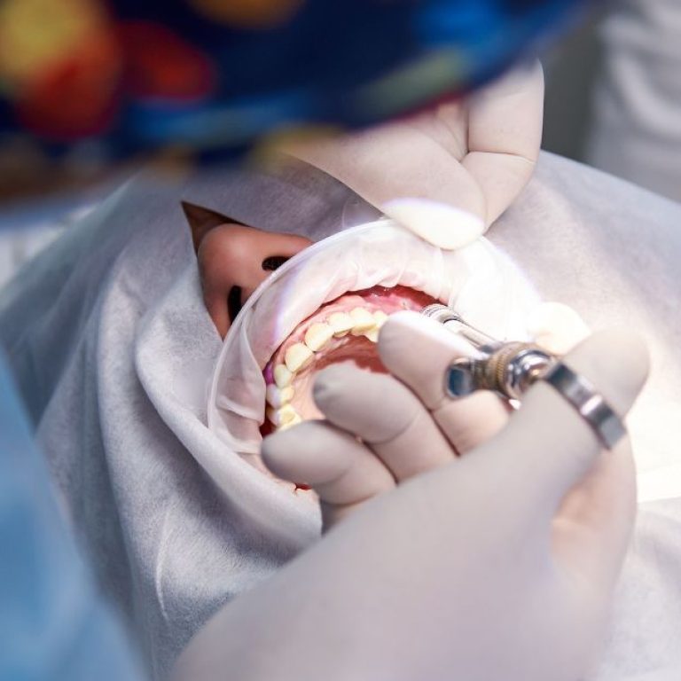 MDW Centre -Smile Brighter with the Best Dental Surgeon in Aligarh