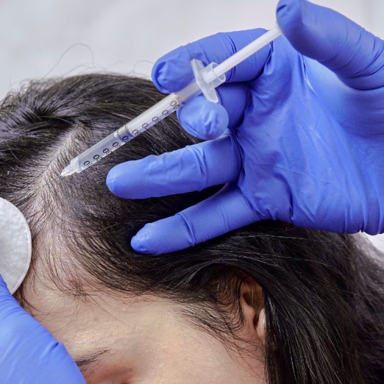 MDW Centre - Why Dr Lokesh Tomar Is Trusted as the Best Hair Specialist in Aligarh