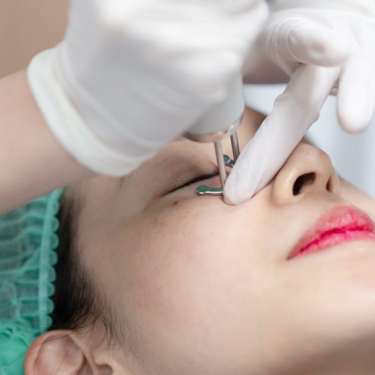 Refresh Tired Eyes with the Best Under Eye Toning in Aligarh